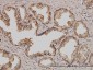 PSMD5 Antibody (monoclonal) (M01)